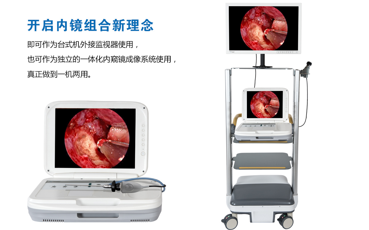 用戶反饋：YKD-9003內(nèi)窺鏡攝像機(jī)獲得好評(píng)