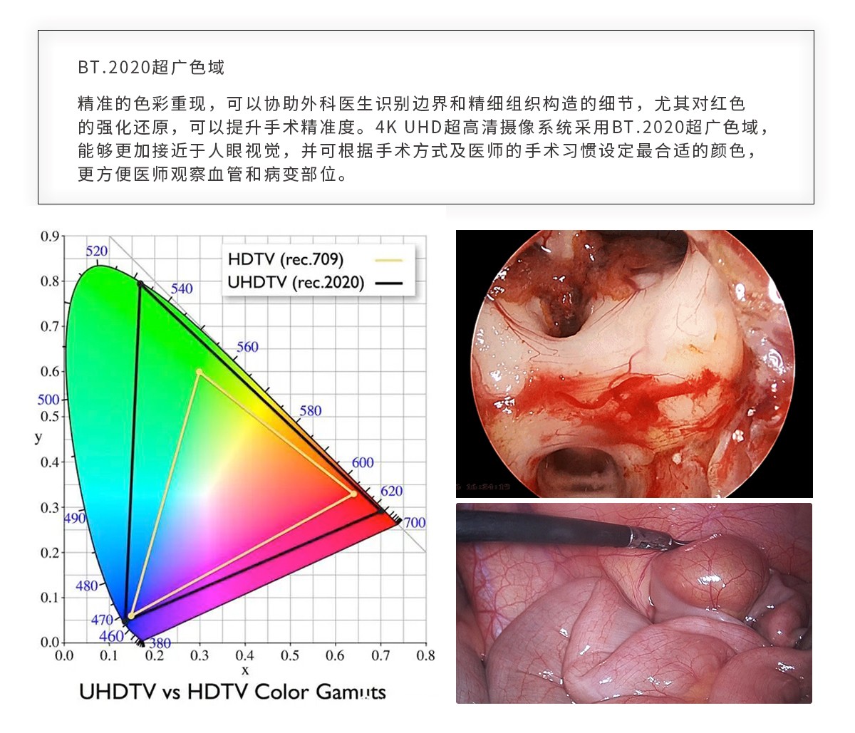 【4K醫(yī)用內(nèi)窺鏡攝像系統(tǒng)】您的第一臺(tái)“4K”找到了嗎？