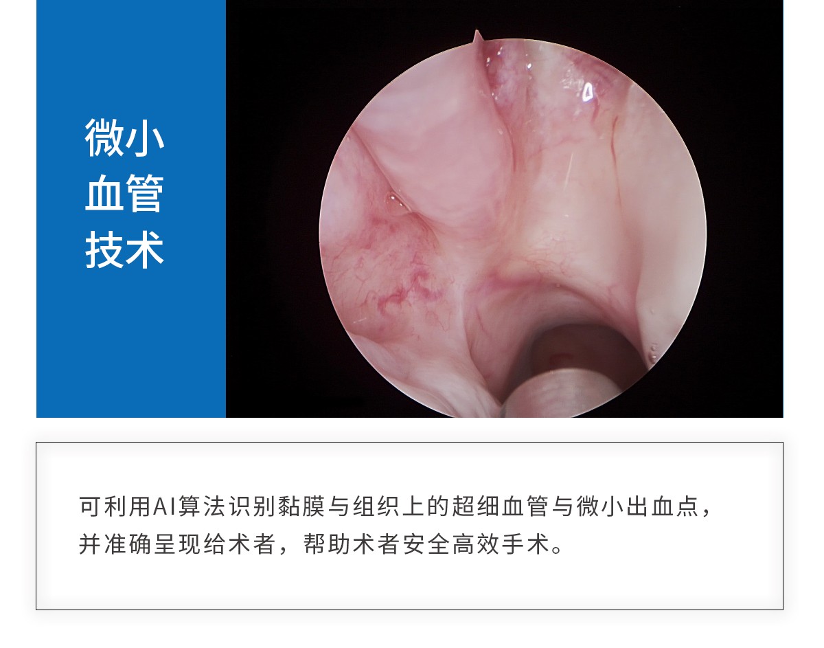 【4K醫(yī)用內(nèi)窺鏡攝像系統(tǒng)】您的第一臺(tái)“4K”找到了嗎？