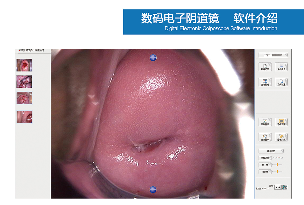 益柯達數(shù)碼電子陰道鏡打包發(fā)貨