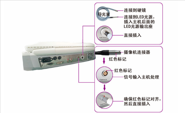 內(nèi)窺鏡攝像機(jī)故障分析與排除